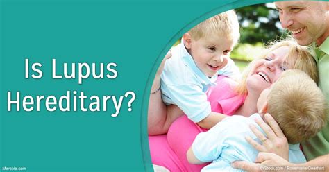 Is Lupus Hereditary?
