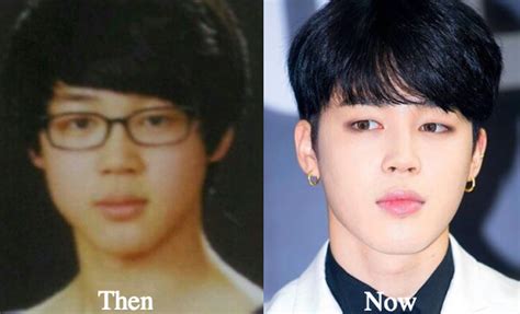 Jimin Plastic Surgery BTS Before and After Photos