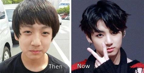 Jungkook BTS Plastic Surgery Before and After Photos