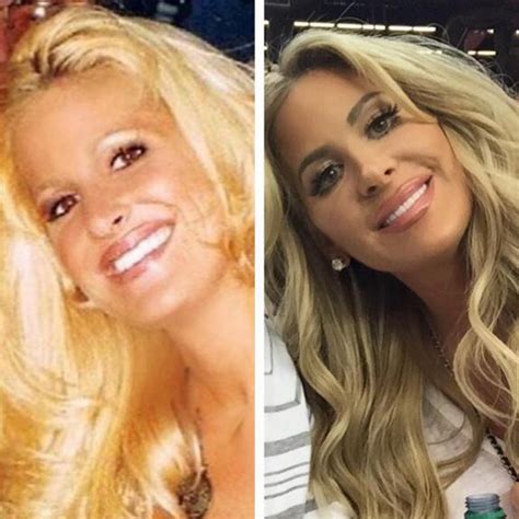 Kim Zolciak Shares Before and After Pics, Still Won t ...
