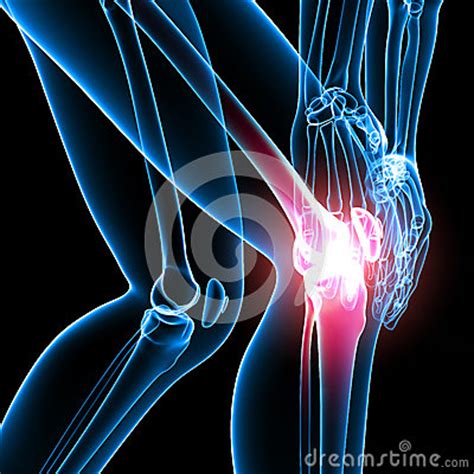 Knee Pain Of Right Leg Skeleton Royalty Free Stock Image ...