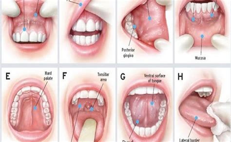 KNOW YOUR MOUTH: ORAL CANCER SIGNS, SYMPTOMS, AND PREVENTION