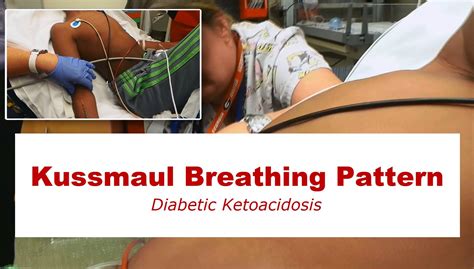 Kussmaul Breathing Pattern   YouTube