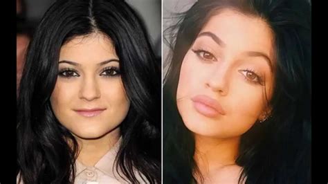 Kylie Jenner   Antes y después   YouTube