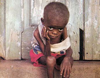 La desnutrición… un problema serio | Pobreza Mundial