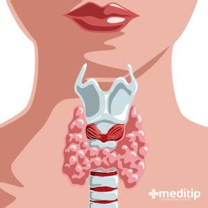 La enfermedad de la tiroides y el embarazo   Meditip