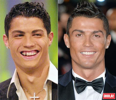 La evolución de la sonrisa de Cristiano Ronaldo