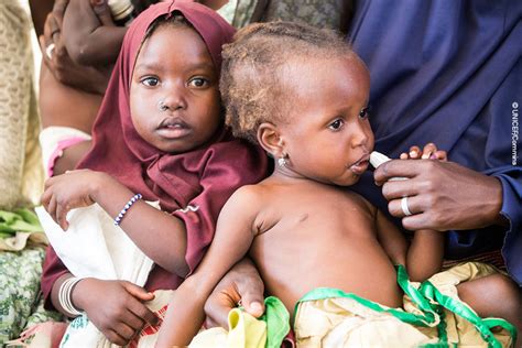 La hambruna amenaza la vida de 1,4 millones de niños en 4 ...