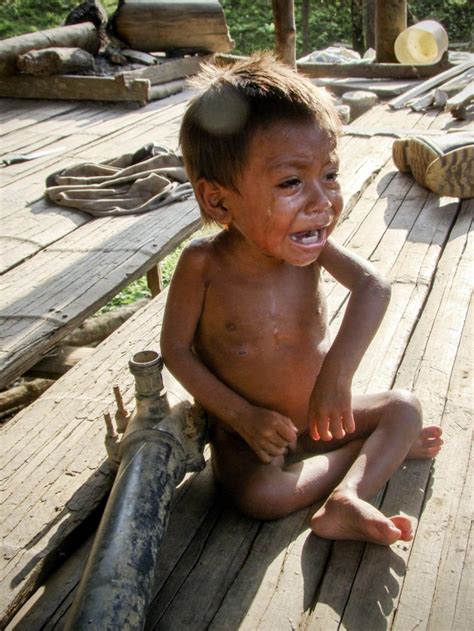 La infancia maltratada por la desnutrición en Colombia ...