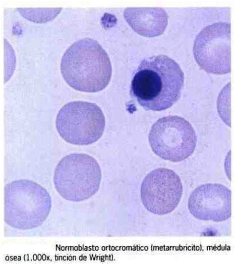 Laboratorio Clínico: Morfología normal de los eritrocitos.