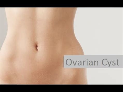Laparoscopic ovarian cystectomy .The  rolling technique ...