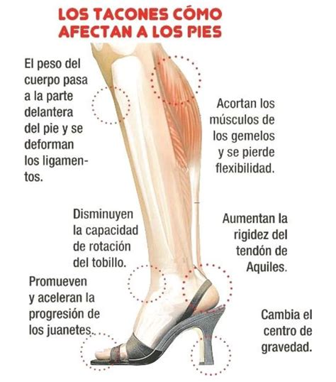 Las lesiones más comunes al caminar con tacones