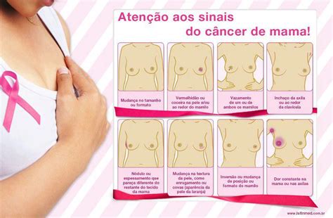 Liga das Acácias: Atenção aos sinais de Câncer do mama!