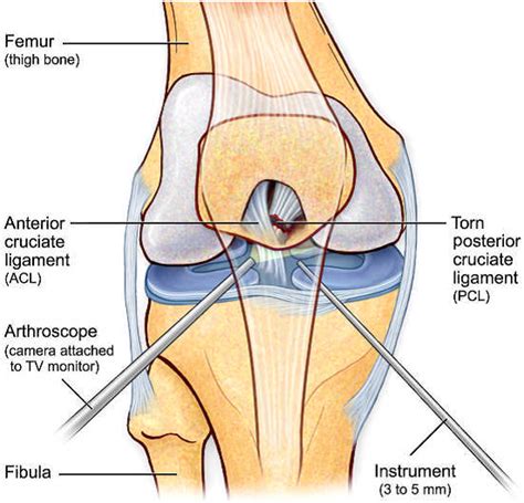 ligament laxity   Pokemon Go Search for: tips, tricks ...