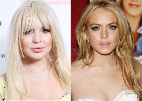 Lindsay Lohan o cómo envejecer gracias a la cirugía y la ...