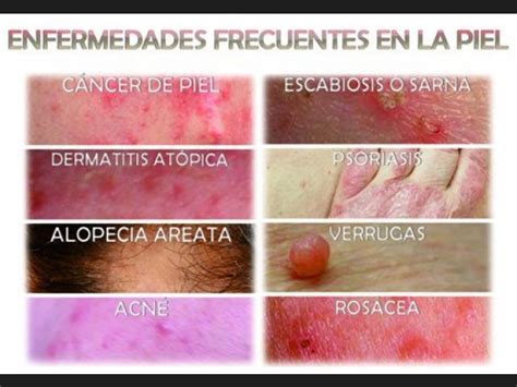 Lista: Enfermedades de la piel más comunes