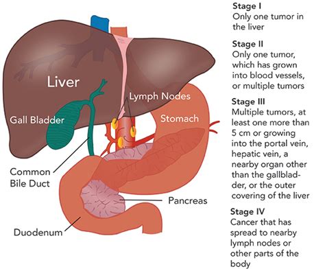 Liver Cancer Symptoms