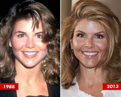 Lori Loughlin Plastic Surgery Before and After Photos ...