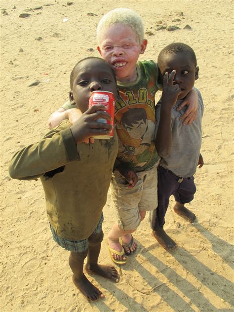 Los albinos de África: “fantasmas de un continente ...