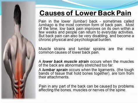 LOWER BACK PAIN CHRONIC AND ACUTE.   ppt video online download