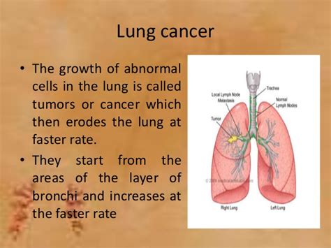 Lung Cancer Symptoms – applecool.info