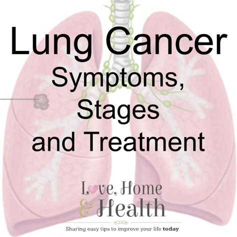Lung Cancer Symptoms, Stages and Alternative Lung Cancer ...