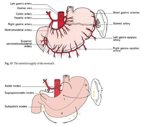 lymph nodes in stomach   DriverLayer Search Engine
