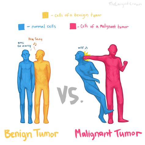 Malignant: Benign And Malignant Tumors Difference