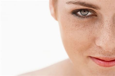 Manchas en la Cara: Qué Es, Síntomas, Causas y Tratamiento