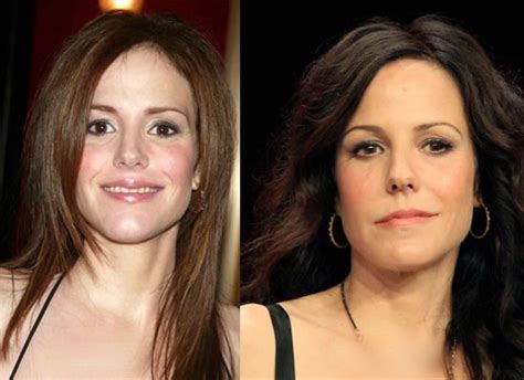 Mary Louise Parker Plastic Surgery Before and After