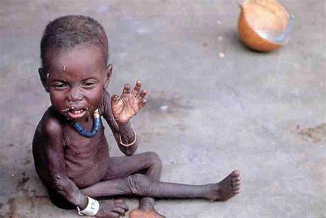 Más de 100 mil muertos por hambruna en África durante el ...