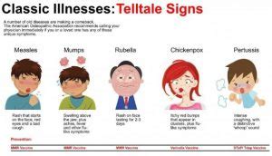 Measles Rash   Pictures, Symptoms, Causes, Treatment ...