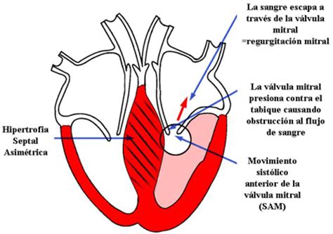 Medicina de Consultorio: Guía de Manejo Miocardiopatía ...