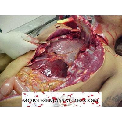 Medicina forense | ANATOMÍA | Pinterest | Medicina y Anatomía
