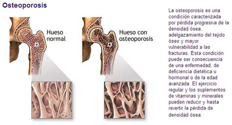 MEDICO INTERNISTA Y REUMATÒLOGO: REUMATOLOGÌA