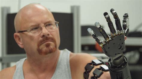 Meet the Man With a Thought Controlled Robotic Arm
