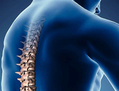 Metástasis en columna vertebral