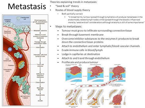 Metastasis Steps to metastases:   ppt video online download