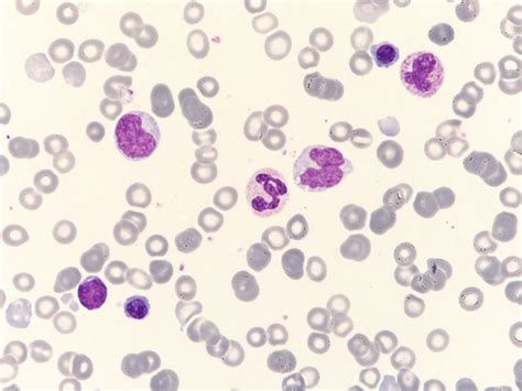 Monocitos abigarrados y eritroblastos