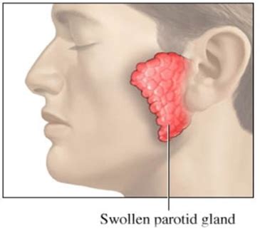 Neck Swellings / Parotid gland surgery