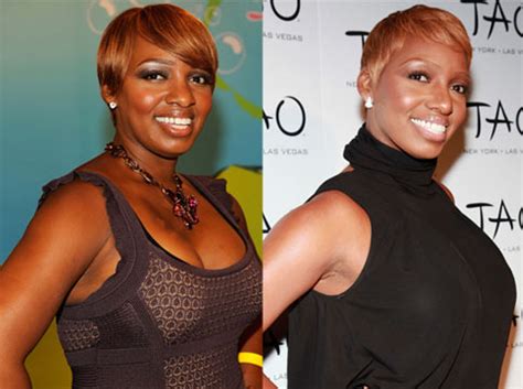 NeNe Leakes Plastic Surgery Before and After   Awful Surgery