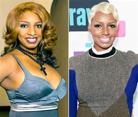 NeNe Leakes | Real Housewives  Plastic Surgery: See Their ...