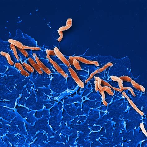 New receptors discovered for Helicobacter pylori