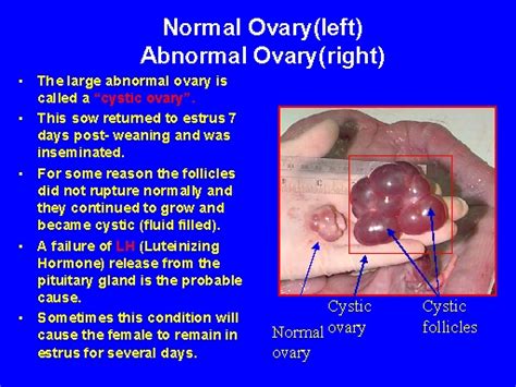 Normal Ovary left