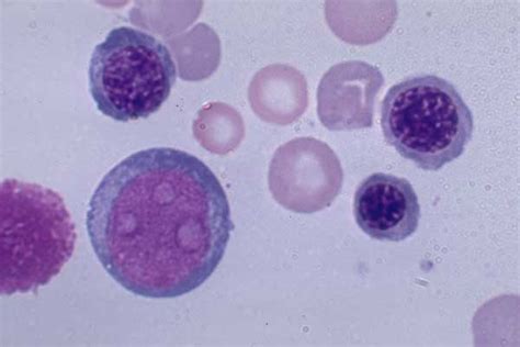 » Nucleated Red Blood Cells  NRBC