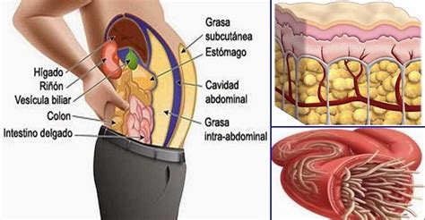 O chá seca barriga: 3 ingredientes para você afinar a ...