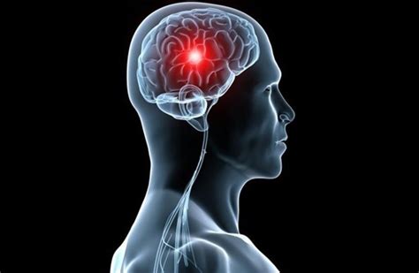 O que é isquemia cerebral e cardíaca e quais seus sintomas