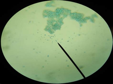 Observación de células procariotas en el yogurt
