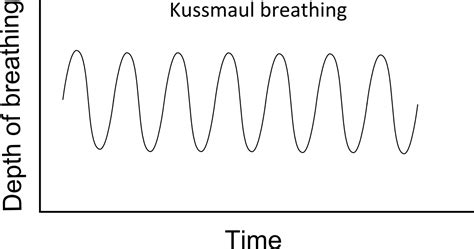 Opinions on Kussmaul breathing