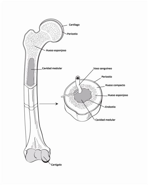 Osteomielitis Mandibular: ¿Qué es la osteomielitis? Causas ...